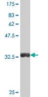 Anti-CAPZA2 Mouse Polyclonal Antibody