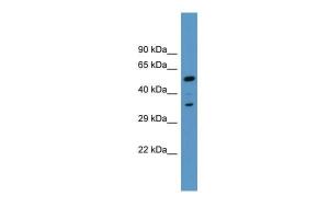 Anti-MARCKS Rabbit Polyclonal Antibody