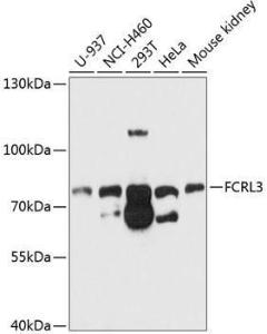 Anti-FCRL3 Rabbit Polyclonal Antibody