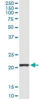 Anti-CLEC1B Antibody Pair