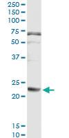 Anti-FGA Antibody Pair