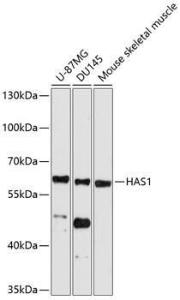 Western blot analysis of extracts of various cell lines, using Anti-HAS1 Antibody (A11318) at 1:1000 dilution