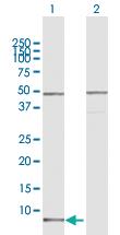 Anti-CCL15 Rabbit Polyclonal Antibody