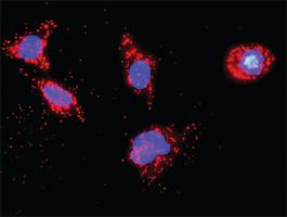 Anti-TP53 + CSNK1D Antibody Pair