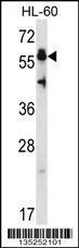 Anti-HSF4 Rabbit Polyclonal Antibody (AP (Alkaline Phosphatase))