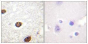 Immunohistochemical analysis of paraffin-embedded human brain using Anti-Histone H3.3 Antibody 1:100 (4°C overnight). The right hand panel represents a negative control, where the antibody was pre-incubated with the immunising peptide.