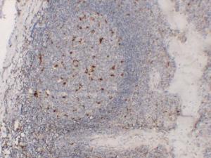 Immunohistochemical analysis of paraffin-embedded human Tonsil using Anti-CD68 Antibody