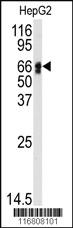 Anti-TRIP6 Rabbit Polyclonal Antibody