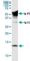 Anti-CCL15 Rabbit Polyclonal Antibody