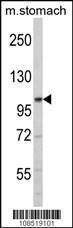 Anti-IRE2 Rabbit Polyclonal Antibody