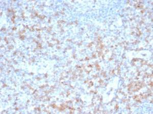 Immunohistochemical analysis of formalin-fixed, paraffin-embedded human tonsil tissue using Anti-CD5 Antibody [rC5/6462]