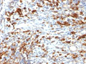 Anti-CD79a Mouse Monoclonal Antibody [clone: IGA/764]