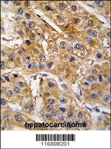 Anti-TRIP6 Rabbit Polyclonal Antibody