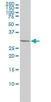 Anti-PRKAB2 Mouse Monoclonal Antibody [clone: 2G9]