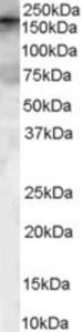 EB07114 (0.1 µg/ml) staining of HeLa Lysate (35 µg protein in RIPA buffer).  Primary incubation was 1 hour.  Detected by chemiluminescence.