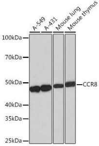 Western blot analysis of extracts of various cell lines, using Anti-CCR8 Antibody [ARC0956] (A305936) at 1:1,000 dilution The secondary antibody was Goat Anti-Rabbit IgG H&L Antibody (HRP) at 1:10,000 dilution Lysates/proteins were present at 25 µg per lane