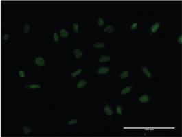 Anti-HMX2 Mouse Monoclonal Antibody [clone: 2D2]