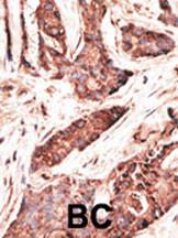 Anti-OASL Rabbit Polyclonal Antibody (Biotin)