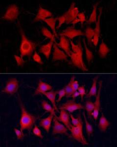 Immunofluorescence analysis of C6 using Anti-PGP9.5 Antibody [ARC50367] (A307670) at a dilution of 1:50 (40x lens). DAPI was used to stain the cell nuclei (blue)