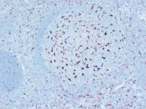 Immunohistochemical analysis of paraffin-embedded human Tonsil using Anti-CD68 Antibody