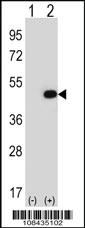 Anti-EIF2B3 Rabbit Polyclonal Antibody