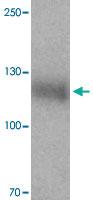 Anti-LEMD3 Rabbit Polyclonal Antibody