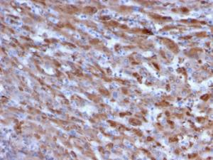 Immunohistochemical analysis of formalin-fixed, paraffin-embedded human liver using Anti-C1QA Antibody [C1QA/2955]