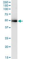 Anti-ACTL6A Antibody Pair