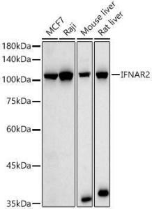 Western blot analysis of various lysates, using Anti-IFNAR2 Antibody (A308822) at 1:1,000 dilution The secondary antibody was Goat Anti-Rabbit IgG H&L Antibody (HRP) at 1:10,000 dilution Lysates/proteins were present at 25 µg per lane