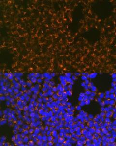 Immunofluorescence analysis of Jurkat cells using Anti-CCR8 Antibody [ARC0956] (A305936) at a dilution of 1:100 (40x lens) DAPI was used to stain the cell nuclei (blue)