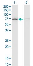 Anti-DAB2 Mouse Monoclonal Antibody [clone: 3D6]