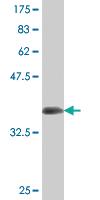 Anti-ATG5 Mouse Monoclonal Antibody [clone: 4B7]