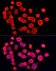 Immunofluorescence analysis of Neuro-2a using Anti-PGP9.5 Antibody [ARC50367] (A307670) at a dilution of 1:50 (40x lens). DAPI was used to stain the cell nuclei (blue)