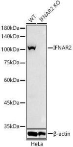 Western blot analysis of extracts from wild type(WT) and IFNAR2 Rabbit polyclonal antibody knockout (KO) HeLa cells, using Anti-IFNAR2 Antibody (A308822) at 1:1,000 dilution