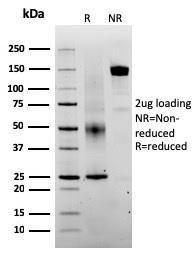 SDS-PAGE analysis of Anti-SERBP1 Antibody [SERBP1/3493] under non-reduced and reduced conditions; showing intact IgG and intact heavy and light chains, respectively. SDS-PAGE analysis confirms the integrity and purity of the antibody.