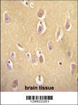 Anti-OR13J1 Rabbit Polyclonal Antibody (AP (Alkaline Phosphatase))