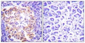 Immunohistochemical analysis of paraffin-embedded human pancreas tissue using Anti-Collagen III Antibody. The right hand panel represents a negative control, where the antibody was pre-incubated with the immunising peptide