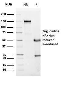 SDS-PAGE analysis of Anti-C1QA Antibody [C1QA/2955] under non-reduced and reduced conditions; showing intact IgG and intact heavy and light chains, respectively. SDS-PAGE analysis confirms the integrity and purity of the antibody