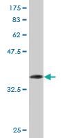 Anti-ATG5 Mouse Monoclonal Antibody [clone: 2G8]