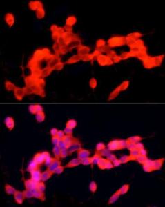 Immunofluorescence analysis of SH-5Y5Y using Anti-PGP9.5 Antibody [ARC50367] (A307670) at a dilution of 1:50 (40x lens). DAPI was used to stain the cell nuclei (blue)