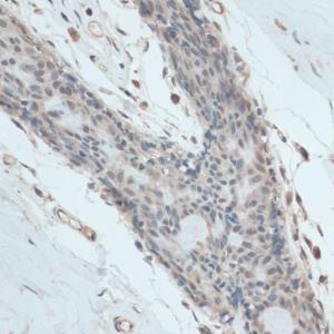 Immunohistochemistry analysis of paraffin-embedded human breast tissue using Anti-GAPDS Antibody (A11323) at a dilution of 1:100 (40X lens). Perform microwave antigen retrieval with 10 mM PBS buffer pH 7.2 before commencing with IHC staining protoco