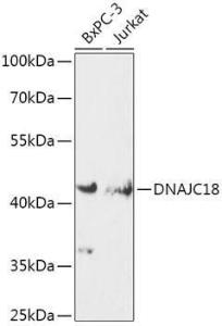 Western blot analysis of extracts of various cell lines, using Anti-DNAJC18 Antibody (A308823) at 1:1,000 dilution. The secondary antibody was Goat Anti-Rabbit IgG H&L Antibody (HRP) at 1:10,000 dilution.