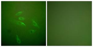 Immunofluorescence analysis of HeLa cells using Anti-Collagen III Antibody. The right hand panel represents a negative control, where the antibody was pre-incubated with the immunising peptide