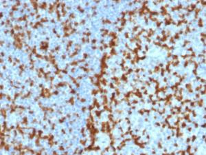 Antibody anti-ZAP70 ZAP702047 100 µg