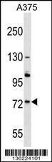 Anti-ACOX2 Rabbit Polyclonal Antibody (HRP (Horseradish Peroxidase))