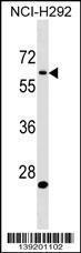 Anti-APBA3 Rabbit Polyclonal Antibody (Biotin)