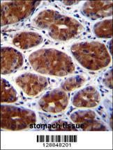 Anti-CPSF3L Rabbit Polyclonal Antibody