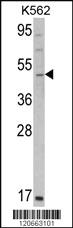 Anti-GATA2 Rabbit Polyclonal Antibody