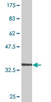 Anti-ATG5 Mouse Monoclonal Antibody [clone: 3E1]