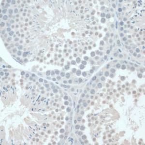 Immunohistochemistry analysis of paraffin-embedded mouse testis using Anti-GAPDS Antibody (A11323) at a dilution of 1:100 (40X lens). Perform microwave antigen retrieval with 10 mM PBS buffer pH 7.2 before commencing with IHC staining protoco